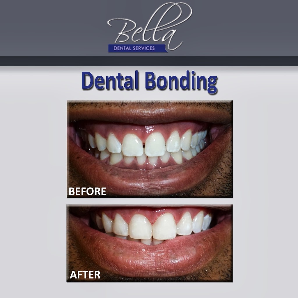 Bella Cosmetic and Family Dentistry, PC | 6292 Lawrenceville Hwy, Tucker, GA 30084, USA | Phone: (770) 659-7606