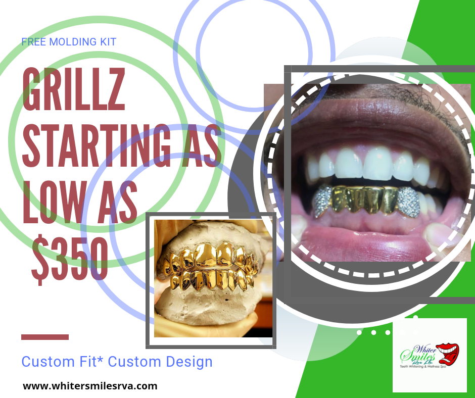 Whiter Smiles RVA | 7282 B Hanover Green Dr, Mechanicsville, VA 23111, USA | Phone: (804) 549-8098